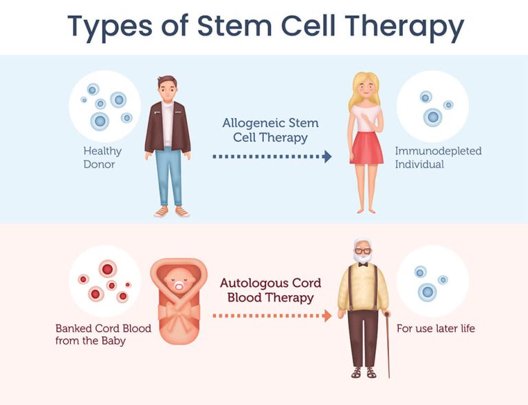 Stem cell therapy explained Securicord